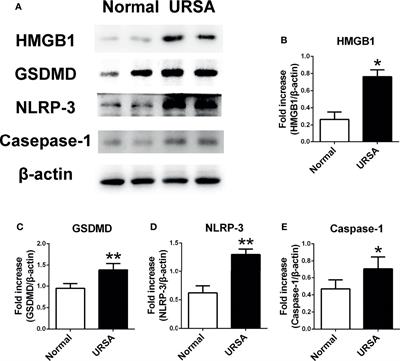 Inhibition of HMGB1 Ameliorates the Maternal-Fetal Interface Destruction in Unexplained Recurrent Spontaneous Abortion by Suppressing Pyroptosis Activation